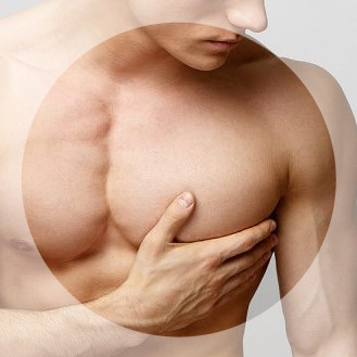 Лечение гинекомастии